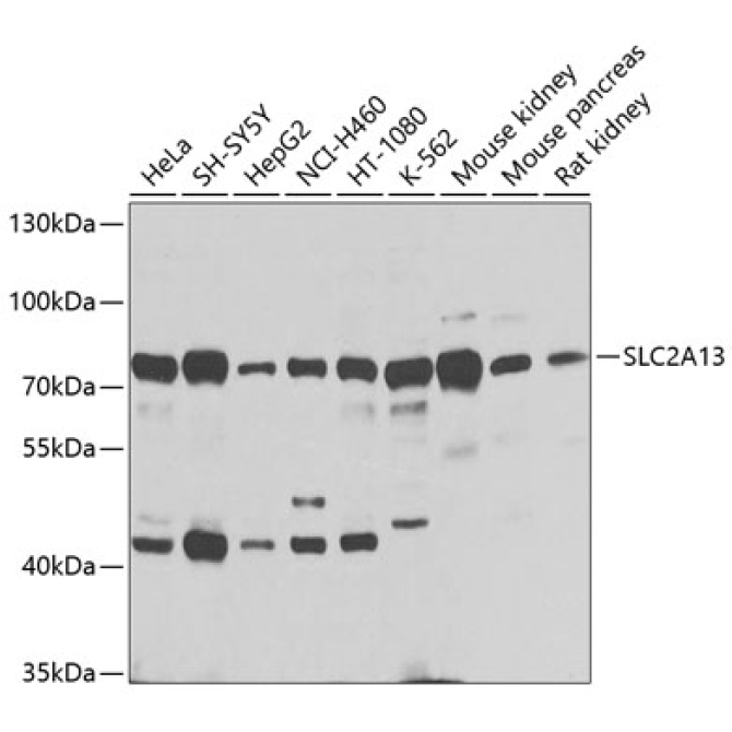 SLC2A13 Rabbit Polyclonal Antibody