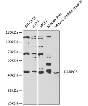 Polyclonal AntibodyPC5 Rabbit Polyclonal Antibody