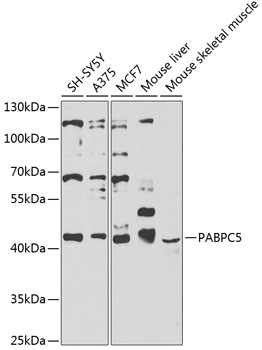 Polyclonal AntibodyPC5 Rabbit Polyclonal Antibody