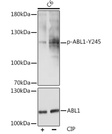 Phospho-c-Abl-Y245 Rabbit Polyclonal Antibody