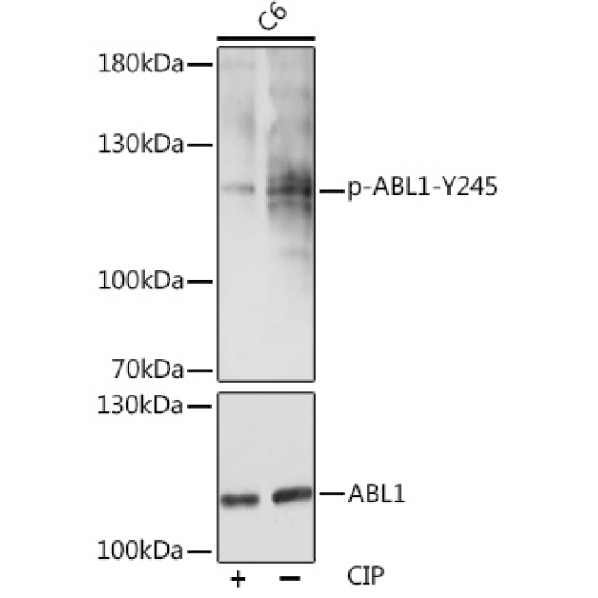 Phospho-c-Abl-Y245 Rabbit Polyclonal Antibody