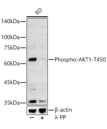 Phospho-AKT1-T450 Rabbit Polyclonal Antibody