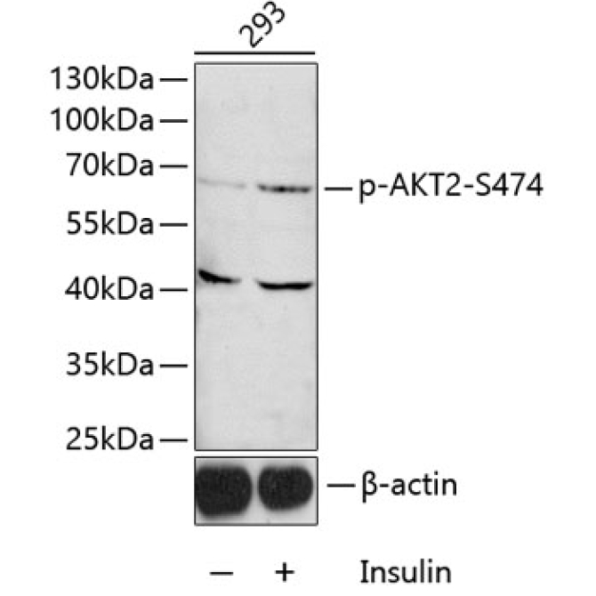 Phospho-AKT2-S474 Rabbit Polyclonal Antibody