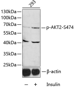 Phospho-AKT2-S474 Rabbit Polyclonal Antibody
