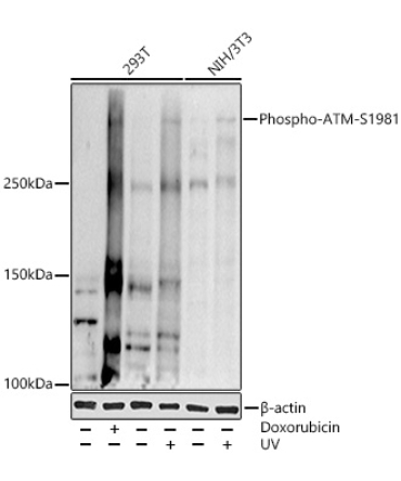 Phospho-ATM-S1981 Rabbit Polyclonal Antibody