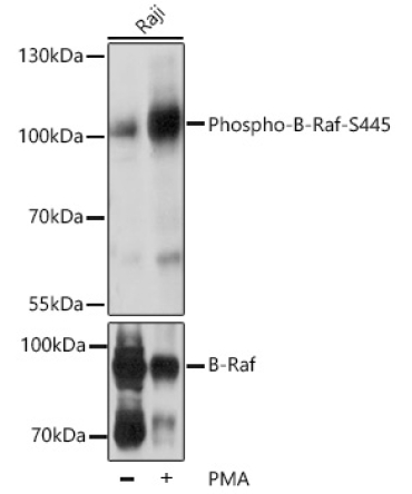 Phospho-B-Raf-S445 Rabbit Polyclonal Antibody