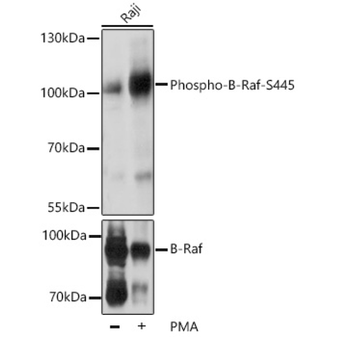 Phospho-B-Raf-S445 Rabbit Polyclonal Antibody