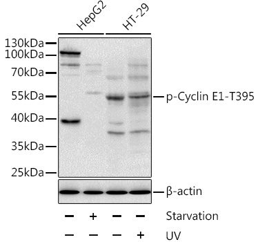 Phospho-Cyclin E1-T395 Rabbit Polyclonal Antibody