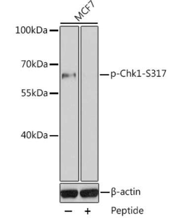 Phospho-Chk1-S317 Rabbit Polyclonal Antibody