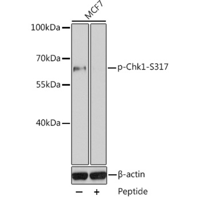 Phospho-Chk1-S317 Rabbit Polyclonal Antibody
