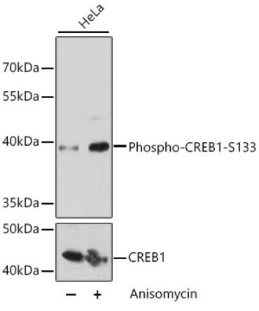 Phospho-CREB1-S133 Rabbit Polyclonal Antibody