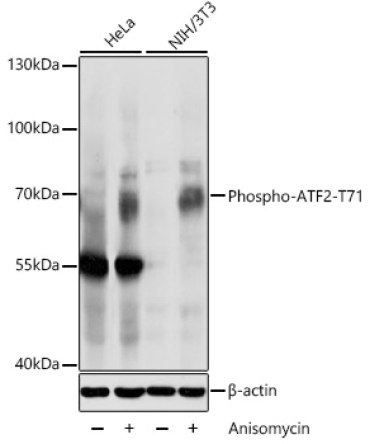 Phospho-ATF2-T71 Rabbit Polyclonal Antibody