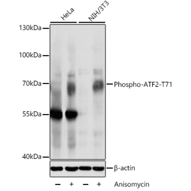 Phospho-ATF2-T71 Rabbit Polyclonal Antibody