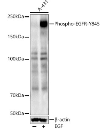 Phospho-EGFR-Y845 Rabbit Polyclonal Antibody