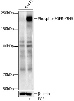 Phospho-EGFR-Y845 Rabbit Polyclonal Antibody