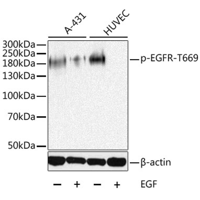 Phospho-EGFR-T669 Rabbit Polyclonal Antibody