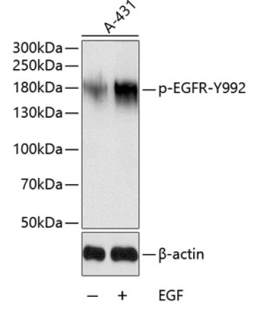 Phospho-EGFR-Y992 Rabbit Polyclonal Antibody