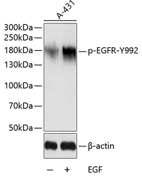 Phospho-EGFR-Y992 Rabbit Polyclonal Antibody
