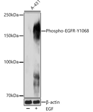 Phospho-EGFR-Y1068 Rabbit Monoclonal Antibody