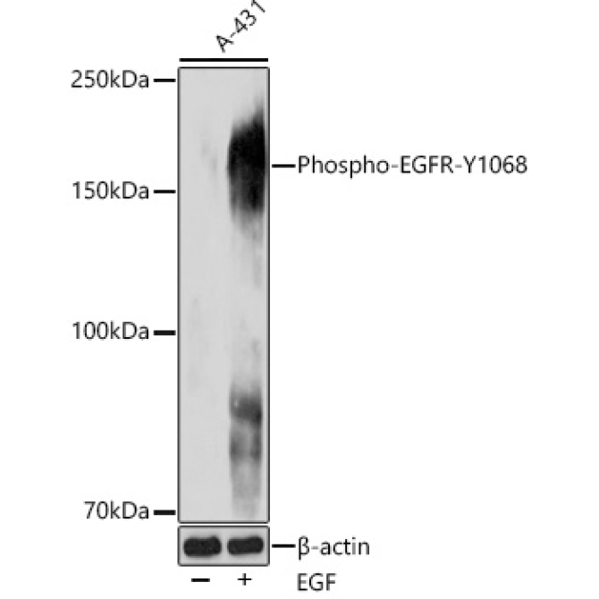 Phospho-EGFR-Y1068 Rabbit Monoclonal Antibody