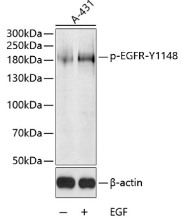 Phospho-EGFR-Y126,600 Rabbit Polyclonal Antibody