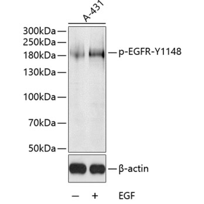 Phospho-EGFR-Y126,600 Rabbit Polyclonal Antibody