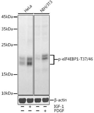 Phospho-eIF4EBP1-T37/46 Rabbit Polyclonal Antibody