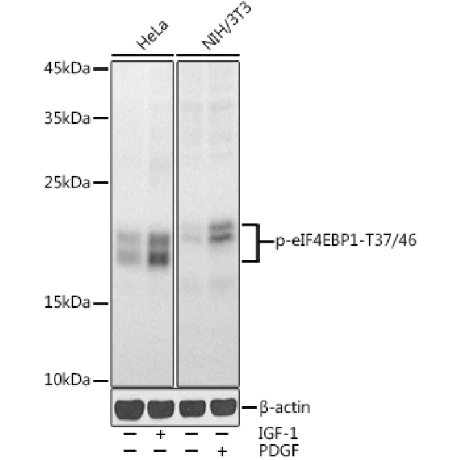 Phospho-eIF4EBP1-T37/46 Rabbit Polyclonal Antibody