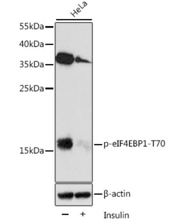 Phospho-eIF4EBP1-T70 Rabbit Polyclonal Antibody