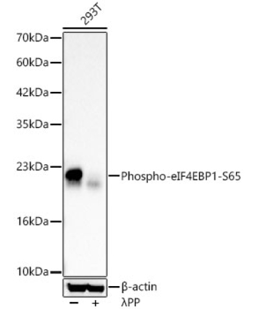 Phospho-eIF4EBP1-S65 Rabbit Polyclonal Antibody