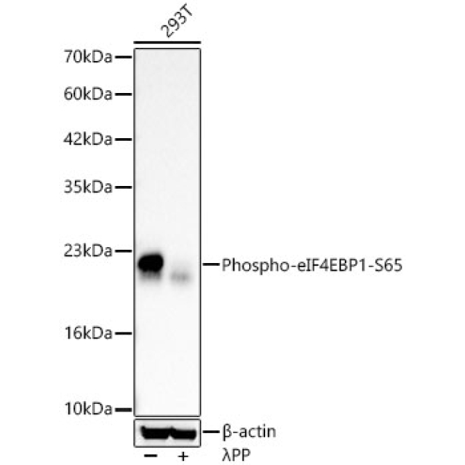 Phospho-eIF4EBP1-S65 Rabbit Polyclonal Antibody