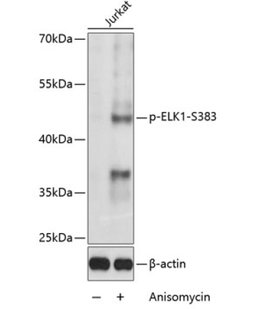 Phospho-ELK1-S383 Rabbit Polyclonal Antibody
