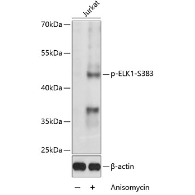 Phospho-ELK1-S383 Rabbit Polyclonal Antibody