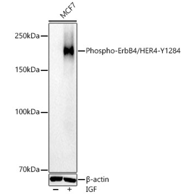 Phospho-ErbB4/HER4-Y1284 Rabbit Polyclonal Antibody