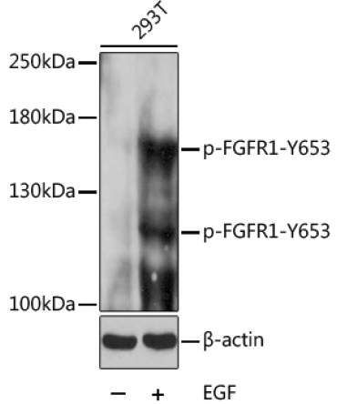 Phospho-FGFR1-Y653 Rabbit Polyclonal Antibody