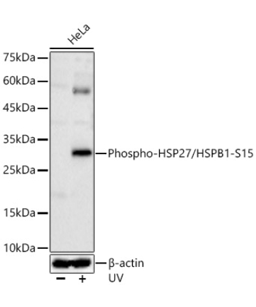 Phospho-HSP27/HSPB1-S15 Rabbit Polyclonal Antibody