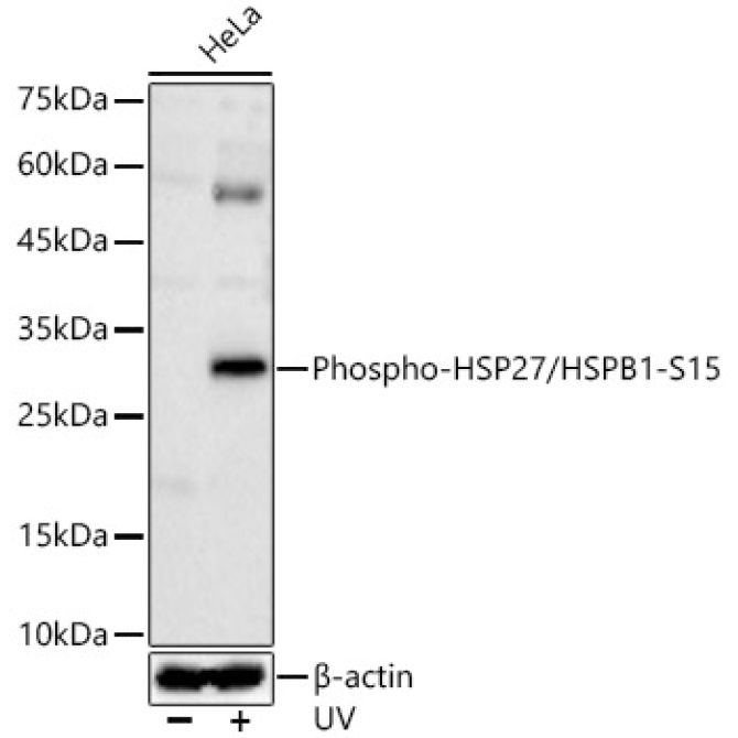 Phospho-HSP27/HSPB1-S15 Rabbit Polyclonal Antibody