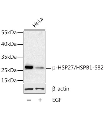 Phospho-HSP27/HSPB1-S82 Rabbit Polyclonal Antibody