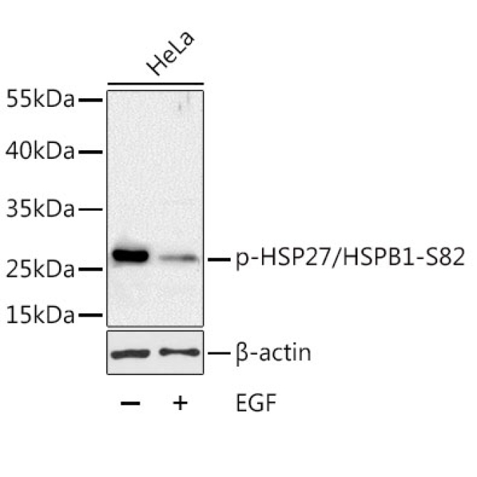 Phospho-HSP27/HSPB1-S82 Rabbit Polyclonal Antibody