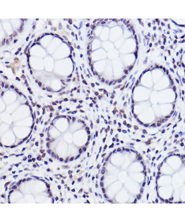 Phospho-c-Jun-S243 Rabbit Polyclonal Antibody