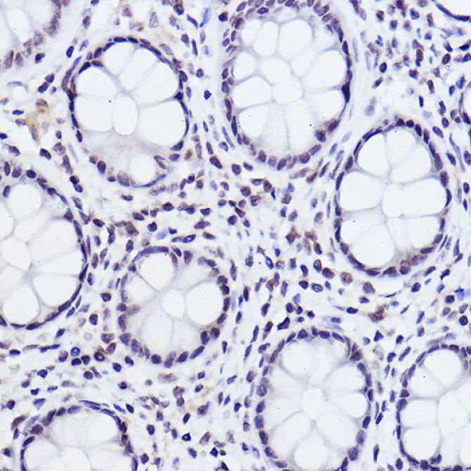Phospho-c-Jun-S243 Rabbit Polyclonal Antibody