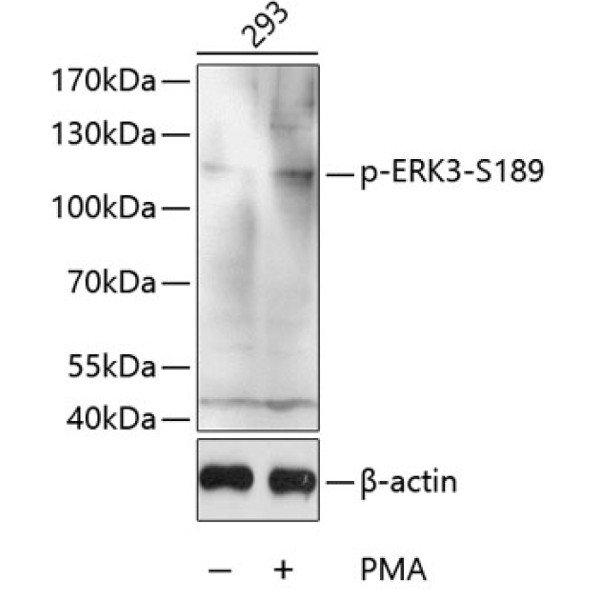 Phospho-ERK3-S189 Rabbit Polyclonal Antibody