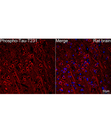 Phospho-Tau-T231 Rabbit Monoclonal Antibody