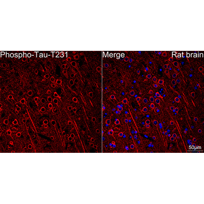 Phospho-Tau-T231 Rabbit Monoclonal Antibody