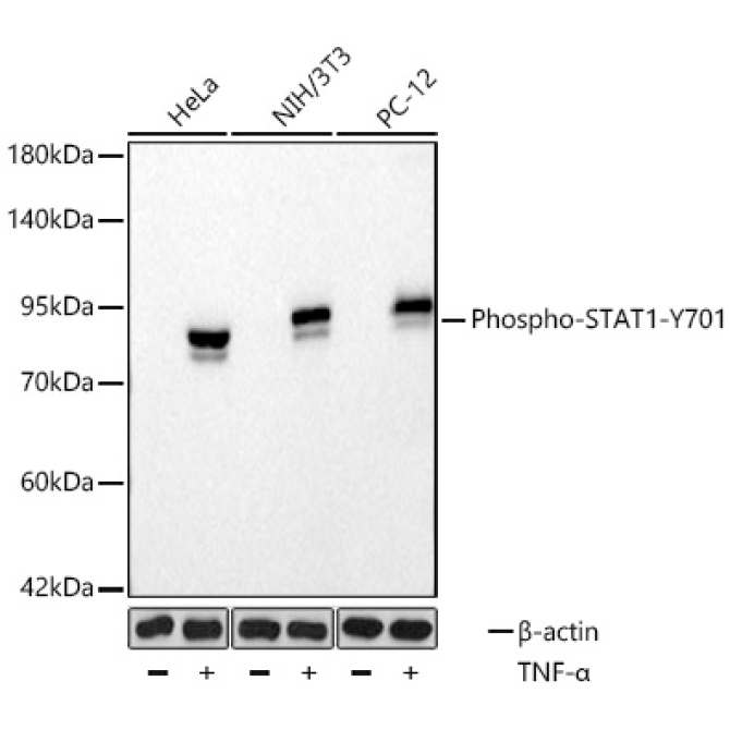 Phospho-STAT1-Y701 Rabbit Monoclonal Antibody