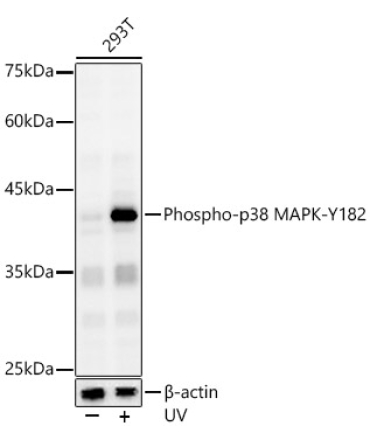 Phospho-p38 MAPK-Y182 Rabbit Polyclonal Antibody
