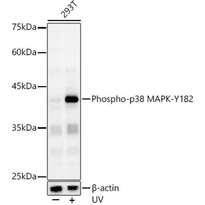 Phospho-p38 MAPK-Y182 Rabbit Polyclonal Antibody