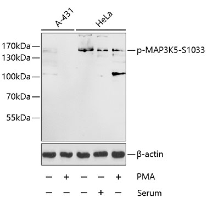 Phospho-MAP3K5-S1033 Rabbit Polyclonal Antibody