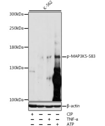 Phospho-MAP3K5-S83 Rabbit Polyclonal Antibody