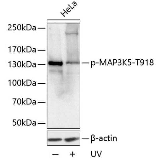 Phospho-MAP3K5-T918 Rabbit Polyclonal Antibody